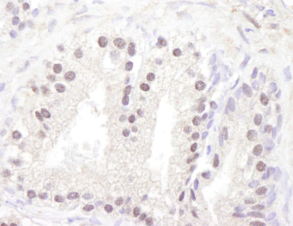 Immunohistochemistry (Formalin/PFA-fixed paraffin-embedded sections) - Anti-ATM antibody (AB17995)