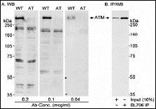 Western blot - Anti-ATM antibody (AB17995)