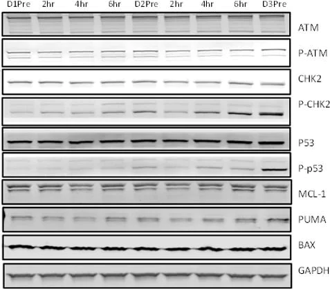 Western blot - Anti-ATM antibody (AB17995)