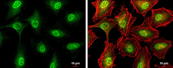Immunocytochemistry/ Immunofluorescence - Anti-ATM antibody (AB226985)