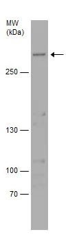 Western blot - Anti-ATM antibody (AB226985)