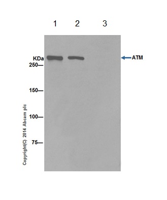Immunoprecipitation - Anti-ATM antibody [EPR17059] (AB199726), expandable thumbnail