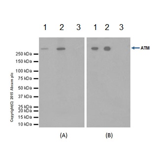 Immunoprecipitation - Anti-ATM antibody [EPR17059] (ab199726), expandable thumbnail