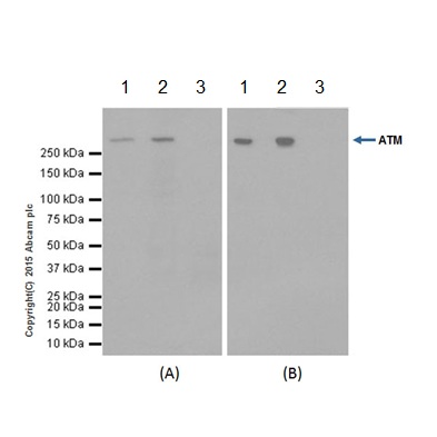 Immunoprecipitation - Anti-ATM antibody [EPR17059] (AB199726), expandable thumbnail