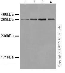 Western blot - Anti-ATM antibody [EPR17059] (AB199726)