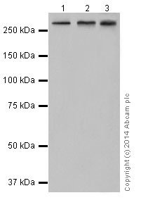 Western blot - Anti-ATM antibody [EPR17059] (AB199726), expandable thumbnail
