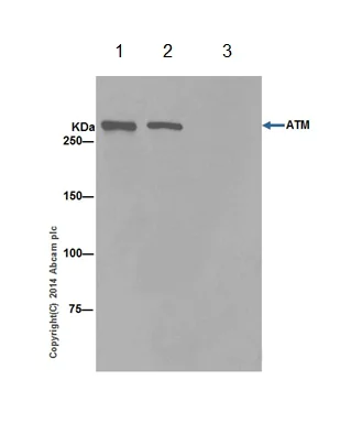 Immunoprecipitation - Anti-ATM antibody [EPR17059] - BSA and Azide free (AB232588)