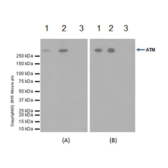 Immunoprecipitation - Anti-ATM antibody [EPR17059] - BSA and Azide free (AB232588)
