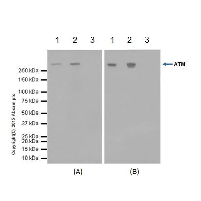 Immunoprecipitation - Anti-ATM antibody [EPR17059] - BSA and Azide free (AB232588)