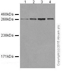 Western blot - Anti-ATM antibody [EPR17059] - BSA and Azide free (AB232588)