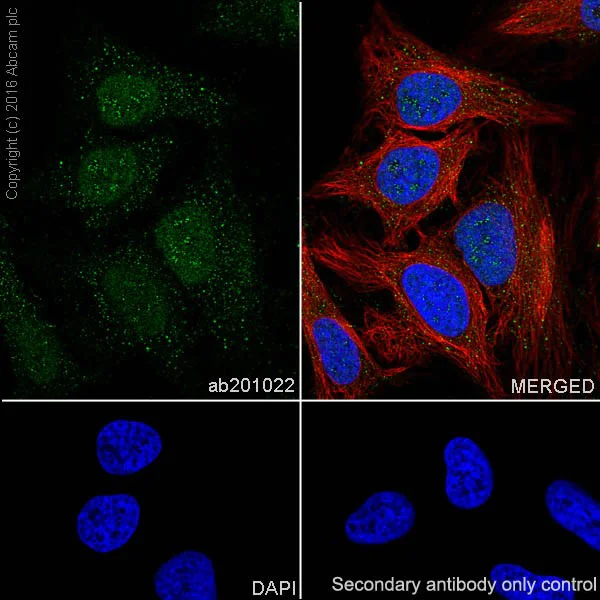 Immunocytochemistry/ Immunofluorescence - Anti-ATM antibody [EPR20100] - ChIP Grade (AB201022)