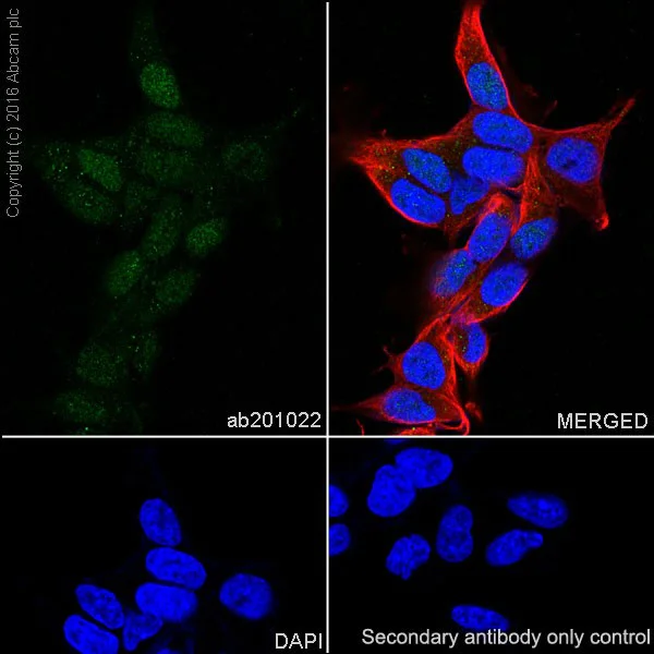 Immunocytochemistry/ Immunofluorescence - Anti-ATM antibody [EPR20100] - ChIP Grade (AB201022)