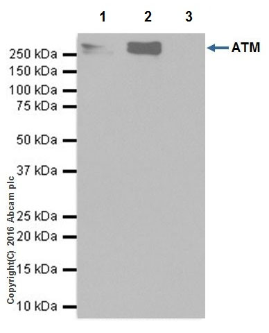 Immunoprecipitation - Anti-ATM antibody [EPR20100] - ChIP Grade (ab201022), expandable thumbnail