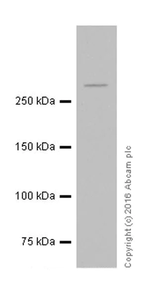 Western blot - Anti-ATM antibody [EPR20100] - ChIP Grade (AB201022)
