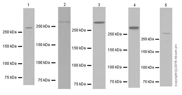 Western blot - Anti-ATM antibody [EPR20100] - ChIP Grade (AB201022)