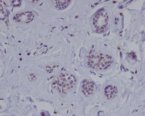 Immunohistochemistry (Formalin/PFA-fixed paraffin-embedded sections) - Anti-ATM antibody [Y170] (AB32420)