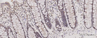 Immunohistochemistry (Formalin/PFA-fixed paraffin-embedded sections) - Anti-ATM antibody [Y170] (AB32420)