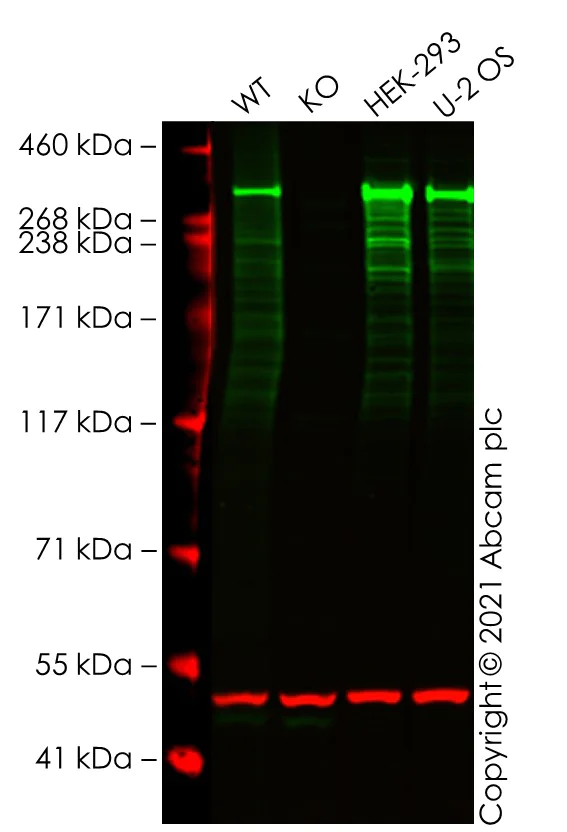 Western blot - Anti-ATM antibody [Y170] (AB32420)