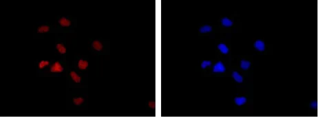 Immunocytochemistry/ Immunofluorescence - Anti-ATM antibody [Y170] - BSA and Azide free (AB216617)
