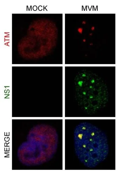 Immunocytochemistry/ Immunofluorescence - Anti-ATM antibody [Y170] - BSA and Azide free (AB216617)