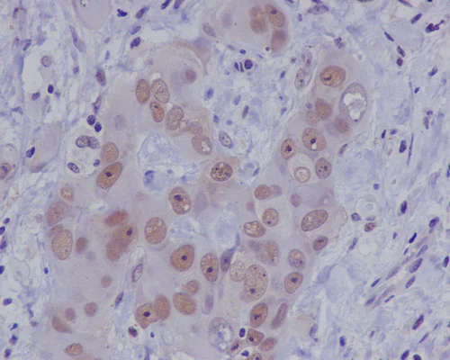 Immunohistochemistry (Formalin/PFA-fixed paraffin-embedded sections) - Anti-ATM antibody [Y170] - BSA and Azide free (AB216617)
