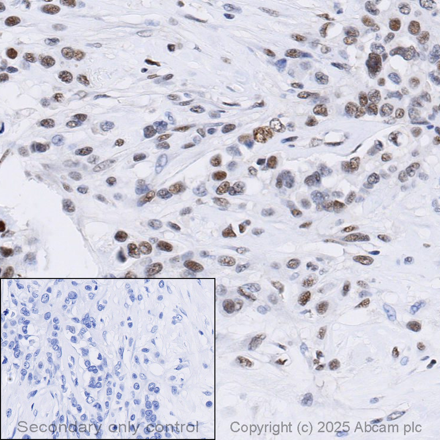 Immunohistochemistry (Formalin/PFA-fixed paraffin-embedded sections) - Anti-ATM antibody [Y170] - BSA and Azide free (AB216617)
