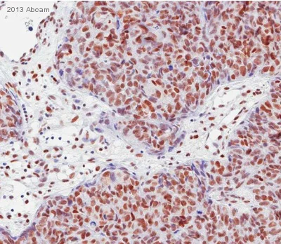 Immunohistochemistry (Formalin/PFA-fixed paraffin-embedded sections) - Anti-ATM antibody [Y170] - BSA and Azide free (AB216617)