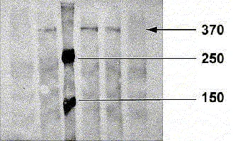 Western blot - Anti-ATM (phospho S1981) antibody [10H11.E12] (AB36810)