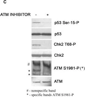 Western blot - Anti-ATM (phospho S1981) antibody [10H11.E12] (AB36810)