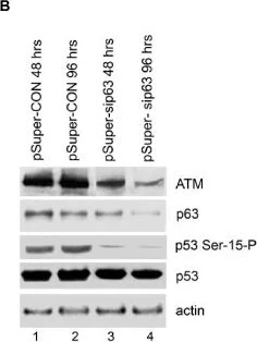 Western blot - Anti-ATM (phospho S1981) antibody [10H11.E12] (AB36810)