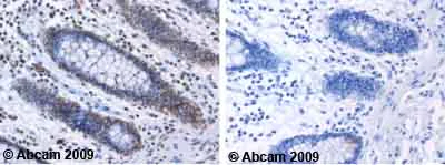 Immunohistochemistry (Formalin/PFA-fixed paraffin-embedded sections) - Anti-ATM (phospho S1981) antibody [10H11.E12] - BSA and Azide free (AB264520)