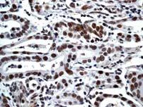 Immunohistochemistry (Formalin/PFA-fixed paraffin-embedded sections) - Anti-ATM (phospho S1981) antibody [EP1890Y] (AB81292)