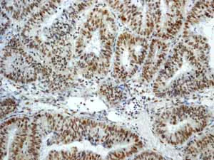 Immunohistochemistry (Formalin/PFA-fixed paraffin-embedded sections) - Anti-ATM (phospho S1981) antibody [EP1890Y] (AB81292)