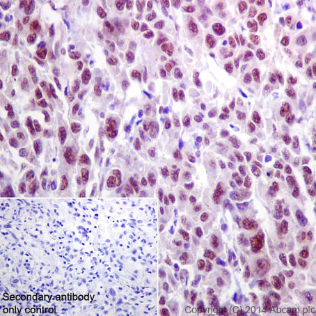 Immunohistochemistry (Formalin/PFA-fixed paraffin-embedded sections) - Anti-ATM (phospho S1981) antibody [EP1890Y] (AB81292)