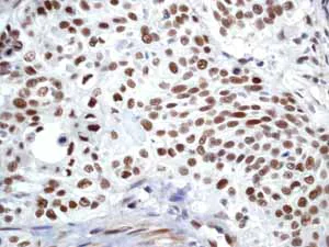 Immunohistochemistry (Formalin/PFA-fixed paraffin-embedded sections) - Anti-ATM (phospho S1981) antibody [EP1890Y] (AB81292)