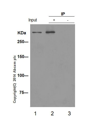 Immunoprecipitation - Anti-ATM (phospho S1981) antibody [EP1890Y] (AB81292)