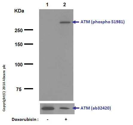 Western blot - Anti-ATM (phospho S1981) antibody [EP1890Y] (AB81292)