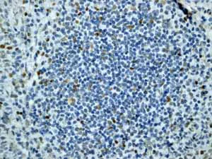 Immunohistochemistry (Formalin/PFA-fixed paraffin-embedded sections) - Anti-ATM (phospho S1981) antibody [EP1890Y] - BSA and Azide free (AB208775)