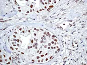Immunohistochemistry (Formalin/PFA-fixed paraffin-embedded sections) - Anti-ATM (phospho S1981) antibody [EP1890Y] - BSA and Azide free (AB208775)