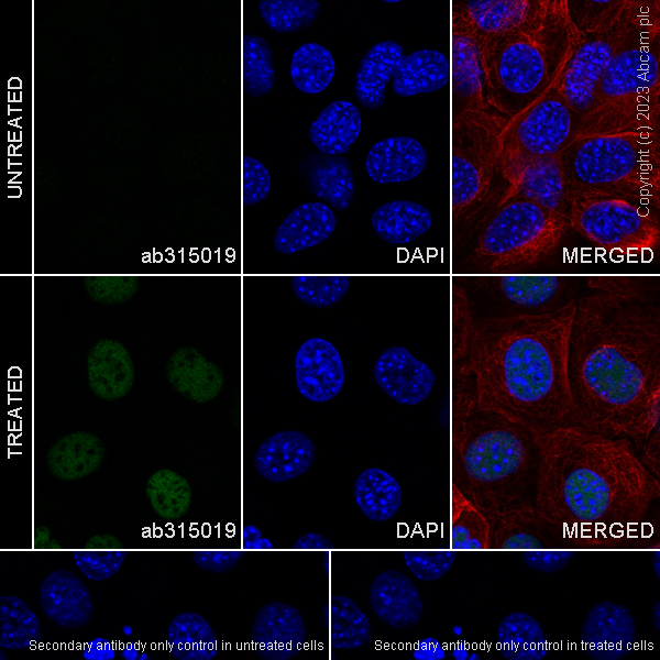 Immunocytochemistry/ Immunofluorescence - Anti-ATM (phospho S1987) antibody [EPR28058-71] (AB315019), expandable thumbnail