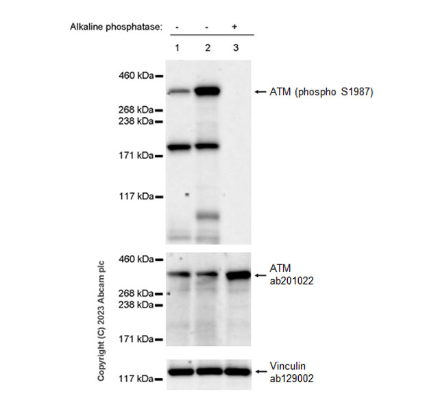 Western blot - Anti-ATM (phospho S1987) antibody [EPR28058-71] (AB315019), expandable thumbnail