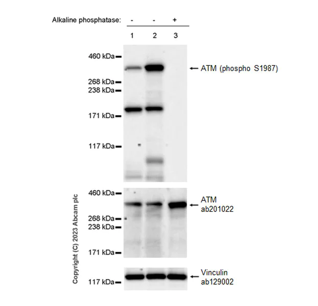 Western blot - Anti-ATM (phospho S1987) antibody [EPR28058-71] (AB315019)