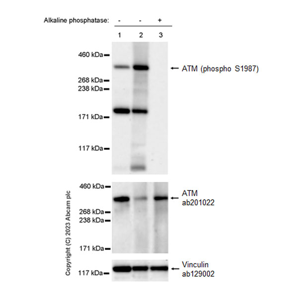 Western blot - Anti-ATM (phospho S1987) antibody [EPR28058-71] (AB315019), expandable thumbnail