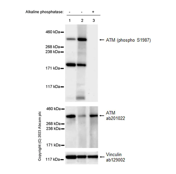 Western blot - Anti-ATM (phospho S1987) antibody [EPR28058-71] (AB315019)