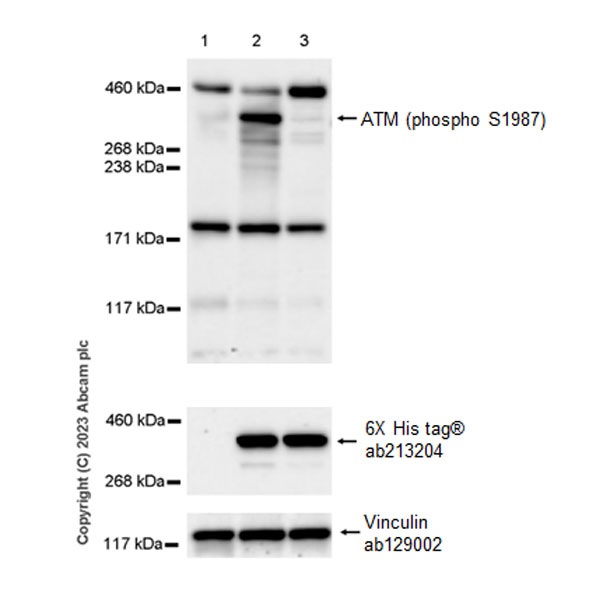 Western blot - Anti-ATM (phospho S1987) antibody [EPR28058-71] (AB315019), expandable thumbnail