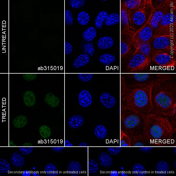 Immunocytochemistry/ Immunofluorescence - Anti-ATM (phospho S1987) antibody [EPR28058-71] - BSA and Azide free (AB315020)