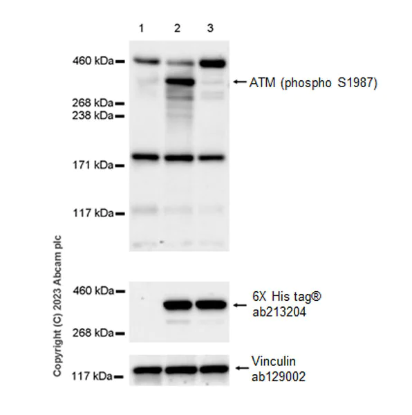 Western blot - Anti-ATM (phospho S1987) antibody [EPR28058-71] - BSA and Azide free (AB315020)