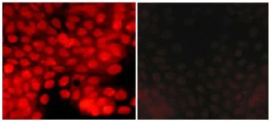 Immunocytochemistry - Anti-ATM (phospho S794) antibody (AB119799)