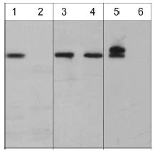 Western blot - Anti-ATM (phospho S794) antibody (AB119799)