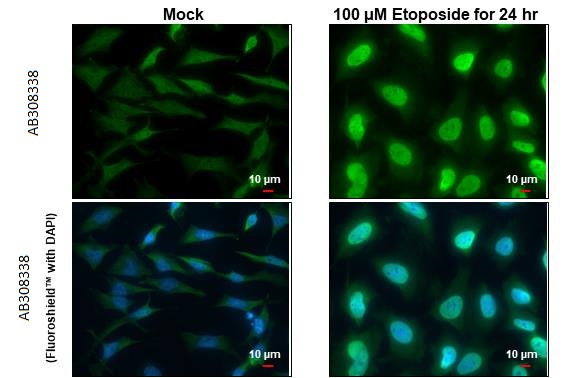 Immunocytochemistry/ Immunofluorescence - Anti-ATM phospho Ser1981 antibody [HL1062] (AB308338), expandable thumbnail